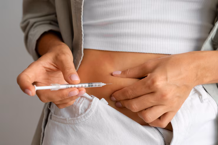 Insulin therapy and CGM guidance